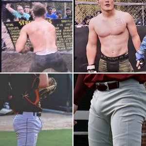 Cup bulges